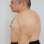 Ozempic Malaysia: Safe, Legitimate Access for Weight Management