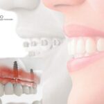 Clínica Vilar Dental Pozuelo – Cuidado dental cercano y profesional