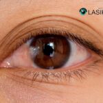 Eye Surgery Pterygium Removal: Restore Vision with Expert Care