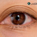 Pterygium Eyedrops: Gentle Relief for Irritation and Redness