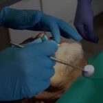 Pediatric Airway Dentist Newmarket | Dr. Ian Gray Dental Group