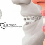 Dentista Pozuelo Avenida Europa | Clínica Vilar Sancho