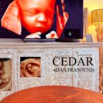 Early Bonding Ultrasound Perth — Connect with Your Baby Before Birth