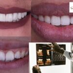 Edhak Dental Center بنها: رعاية فموية مميزة وابتسامة صحية