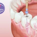 Ortodoncia en Gines: somriure perfecte amb Clinicadentalcristinamora