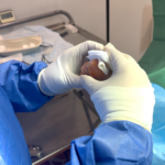 Ingrown Toenail Treatment: Fast Relief & Expert Care