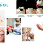 Norlane Dentist: Gentle Care for Every Smile
