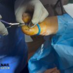 Nail Surgery Birmingham | Fast Results & Personalised Aftercare